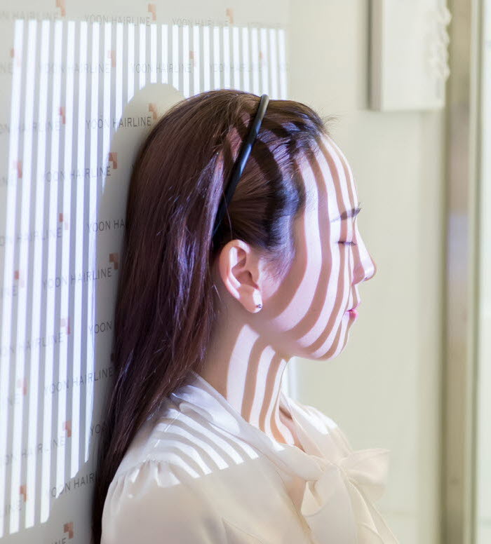 윤헤어라인 디자인 상담 3