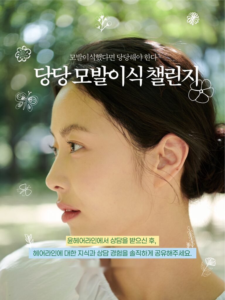 윤헤어라인 당당 모발이식 챌린지 – 여성 헤어라인 모발이식 상담 후기 공유 프로모션 안내