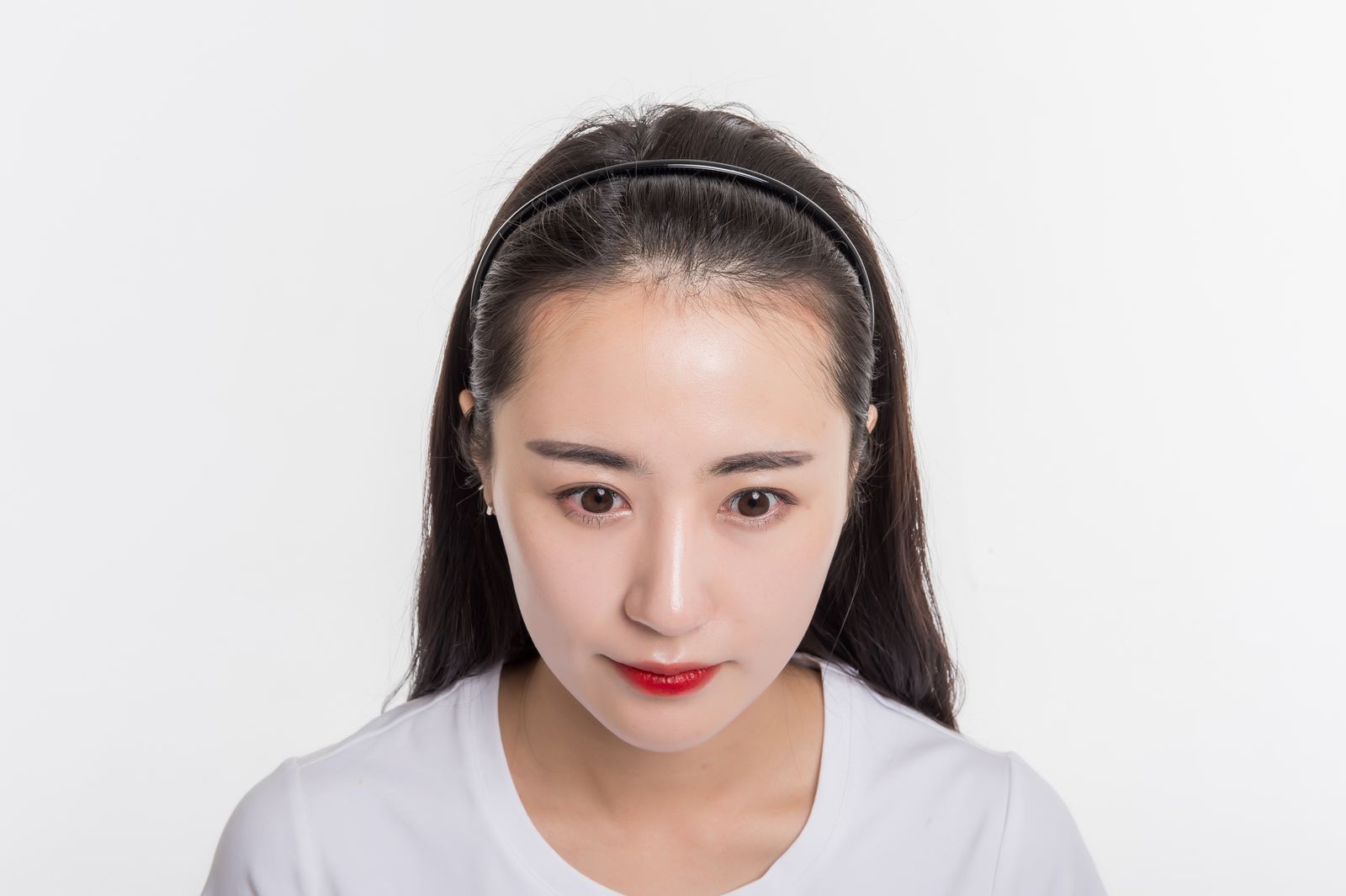 윤헤어라인 리얼 모델 정면 — 이마와 헤어라인