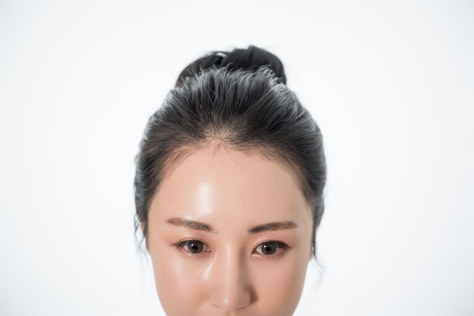 윤헤어라인 리얼 모델의 이마와 헤어라인