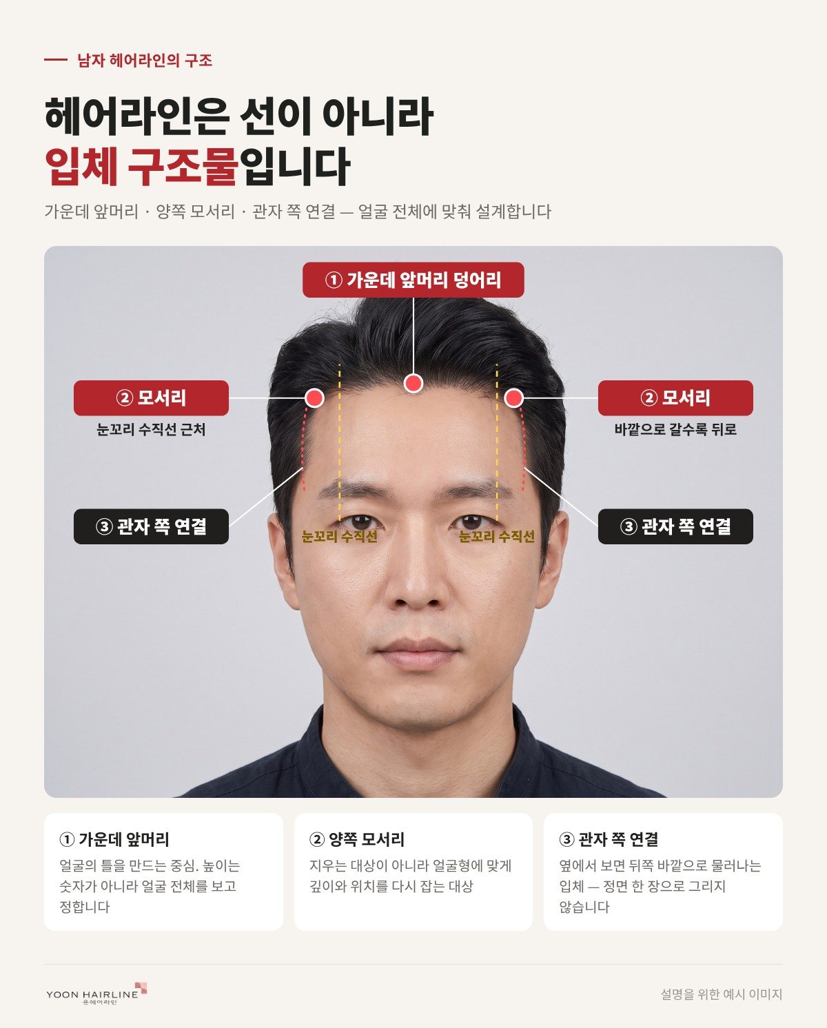 남자 헤어라인의 입체 구조 — 가운데 앞머리, 양쪽 모서리, 관자 쪽 연결