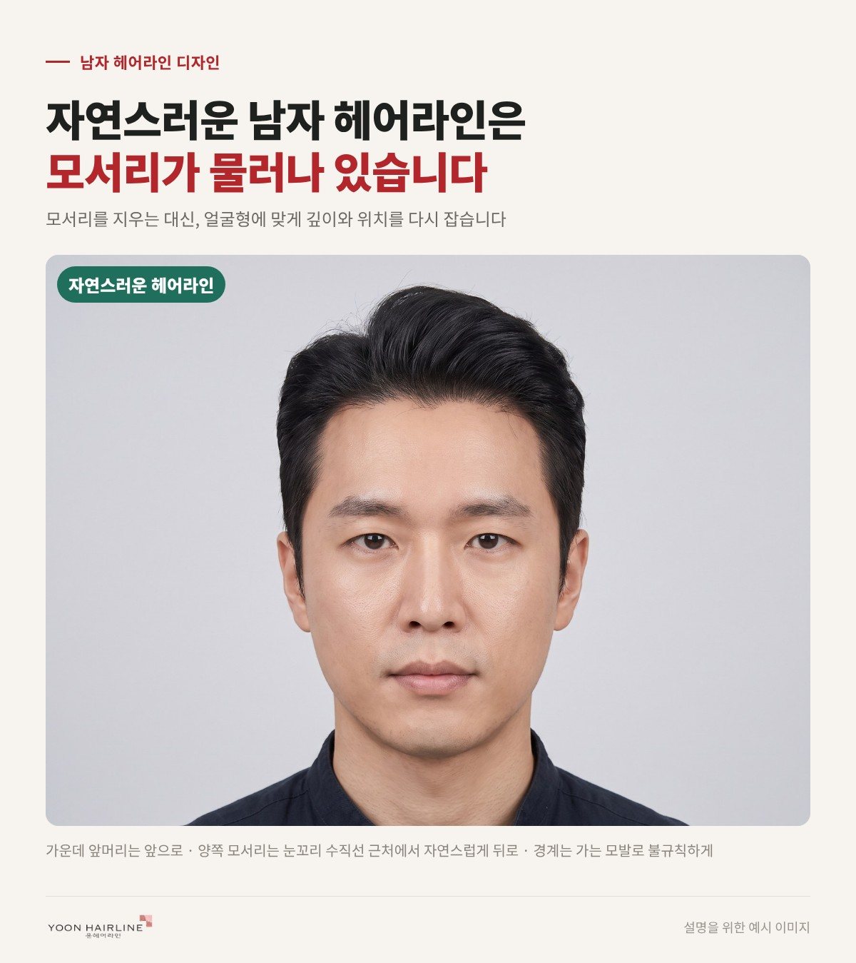 자연스러운 남자 헤어라인 — 모서리가 물러나 있는 모습 예시