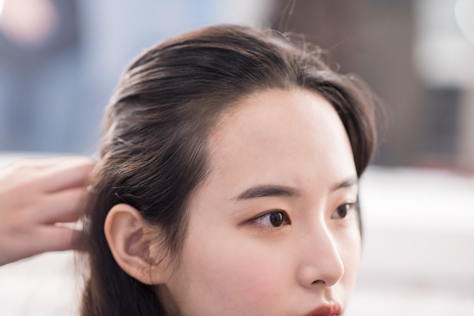 윤헤어라인 리얼 모델 — 이마와 헤어라인 클로즈업