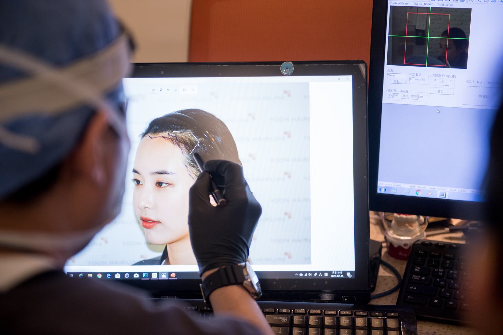 모니터에서 3D 데이터와 메가데이터로 헤어라인을 설계하는 원장
