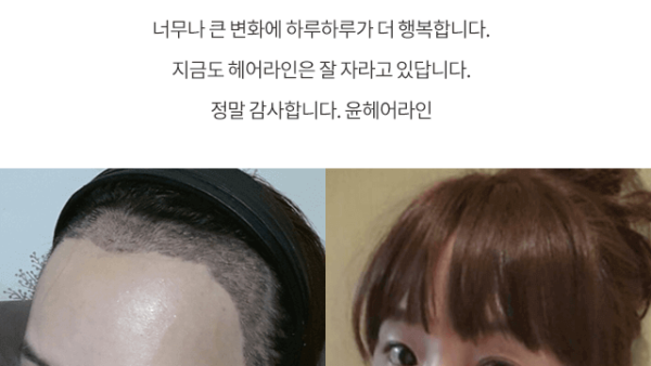 마혜연_비포_리얼06.png