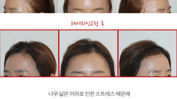 마혜연_애프터_리얼02.png