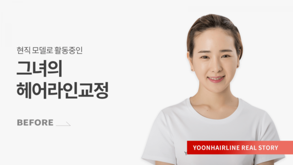김세연 비포