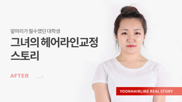 권희수 비포