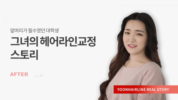권희수 애프터