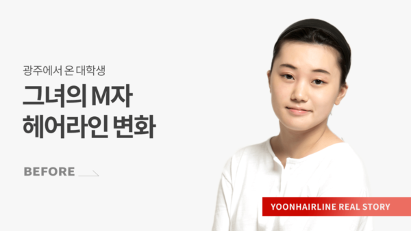백다혜 비포