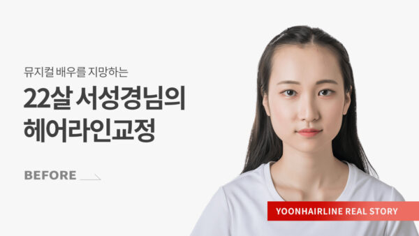 서성경 비포