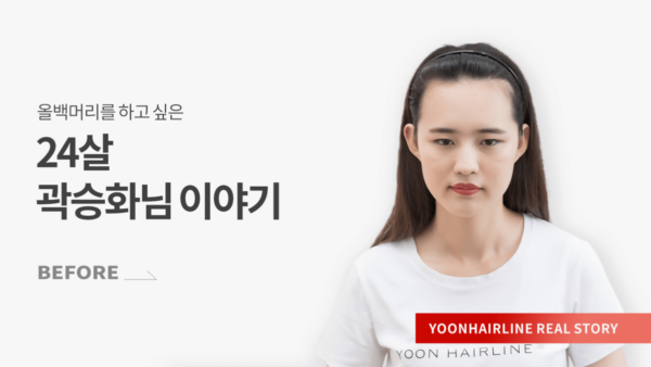 곽승화 비포