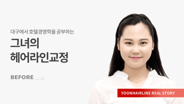 이은지 비포