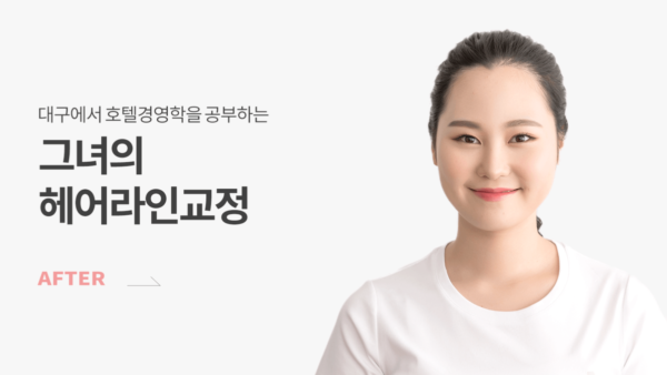 이은지 애프터