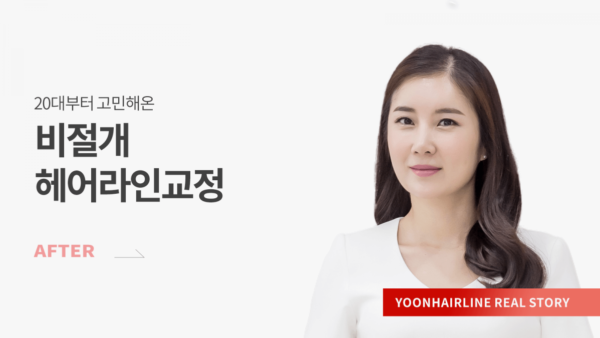 장화선 애프터