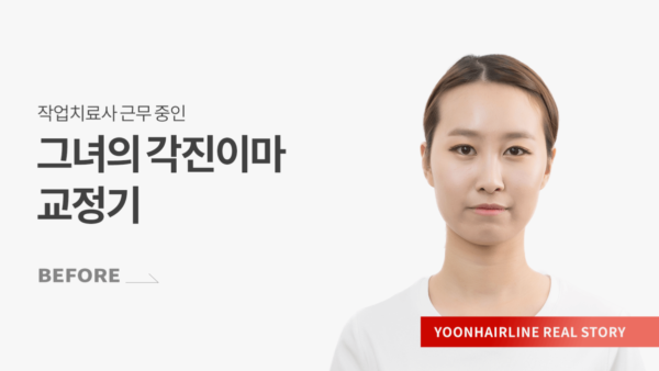 전유미비포