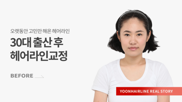 이별선 before