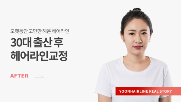 이별선 after