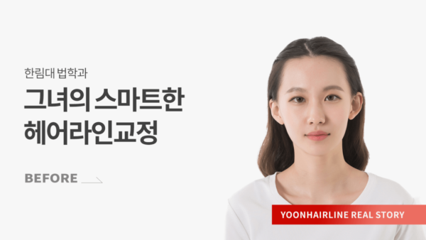 김도혜_비포